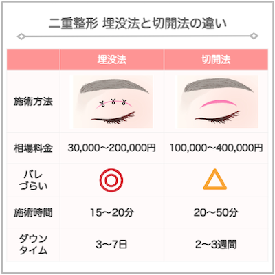 埋没法と切開法の違い