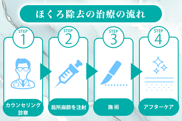 ほくろ除去流れ