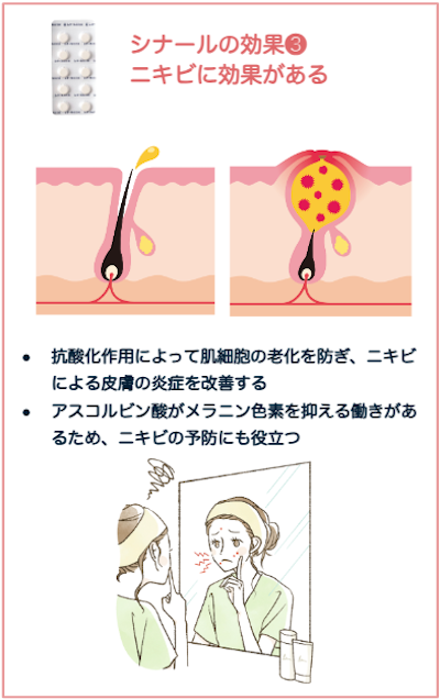 シナール配合錠にはニキビ改善・予防がある