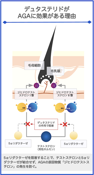 ザガーロ（デュタステリド）がAGAに効果がある理由