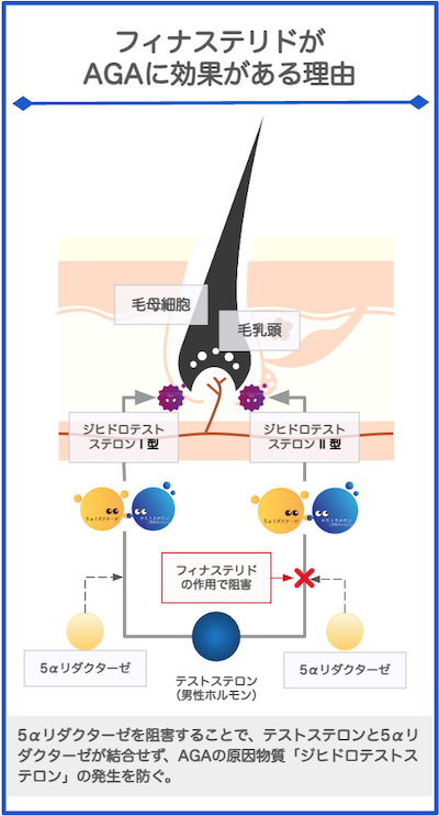 フィナステリド（プロペシア）がAGAに効果がある理由