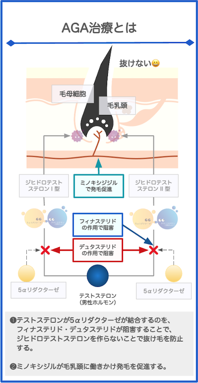 AGA治療とその効果