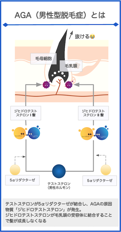 AGAとは