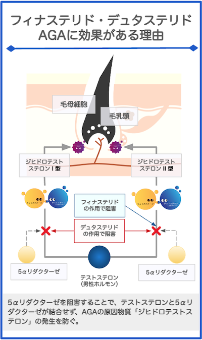 内服薬がAGAに効果がある理由