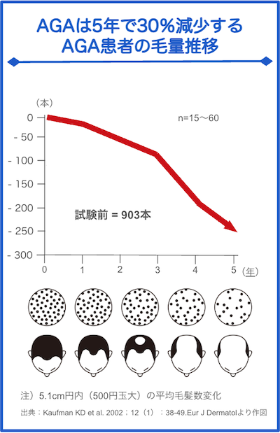 AGAの進行：5年で毛量が30%減る