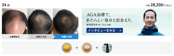 AGAヘアクリニック症例