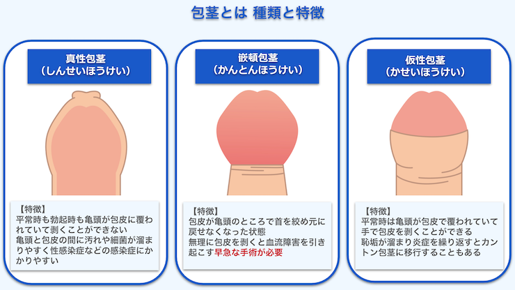 10院比較】池袋で包茎手術ができるおすすめクリニック5選！仮性・真性