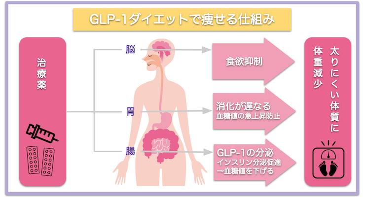 GLP-1ダイエットで痩せる仕組み