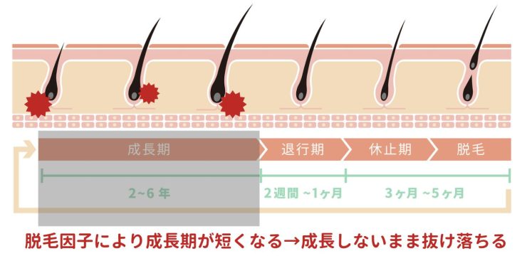 ヘアサイクルの乱れ