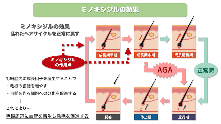 ミノキシジルの効果