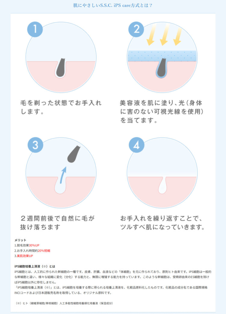 S.S.C. iPS care方式の脱毛の仕組み