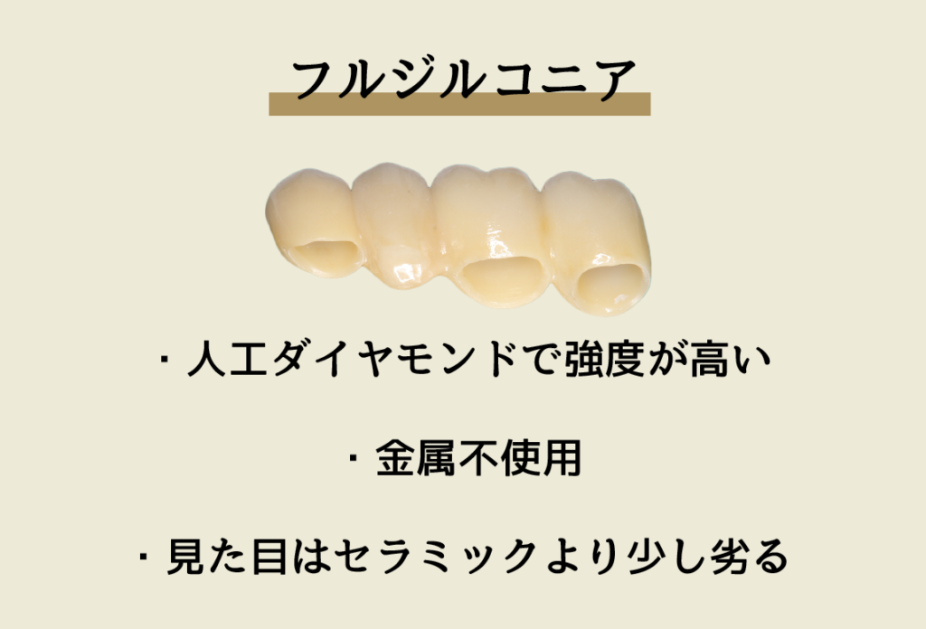 歯のブリッジにはどんな種類がある？現役歯科院長が徹底解説！ ｜ WITH 
