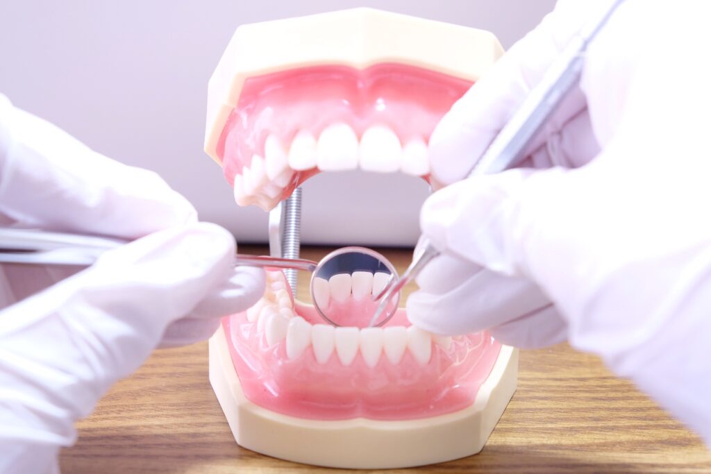 歯石除去の治療の流れ