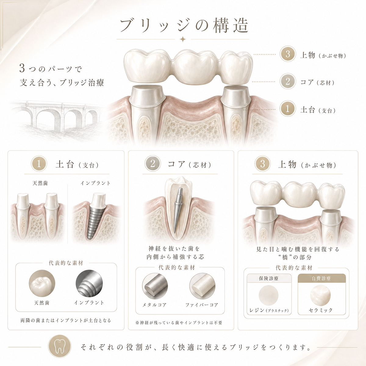 ブリッジ治療について