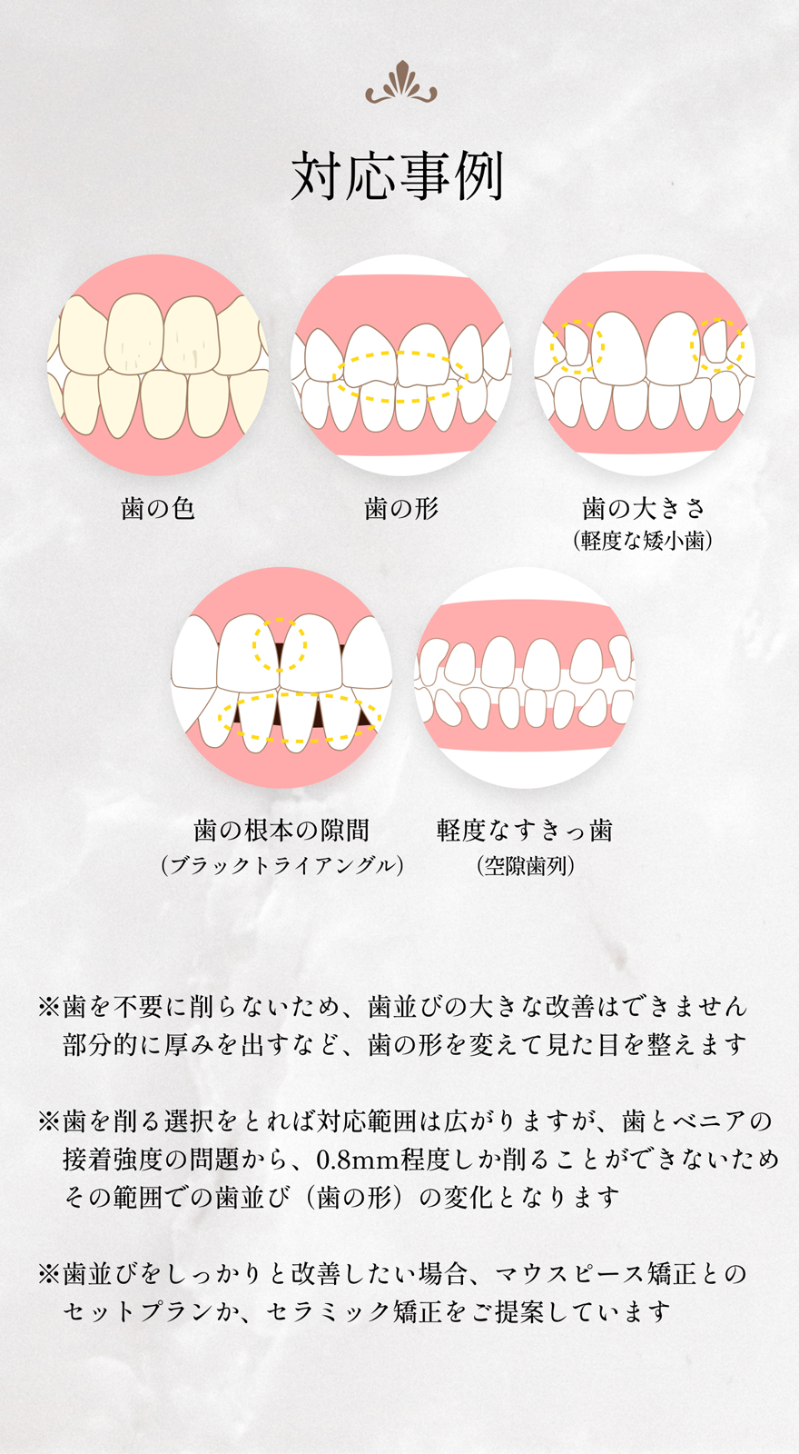 歯を削らないナノベニアの対応症例