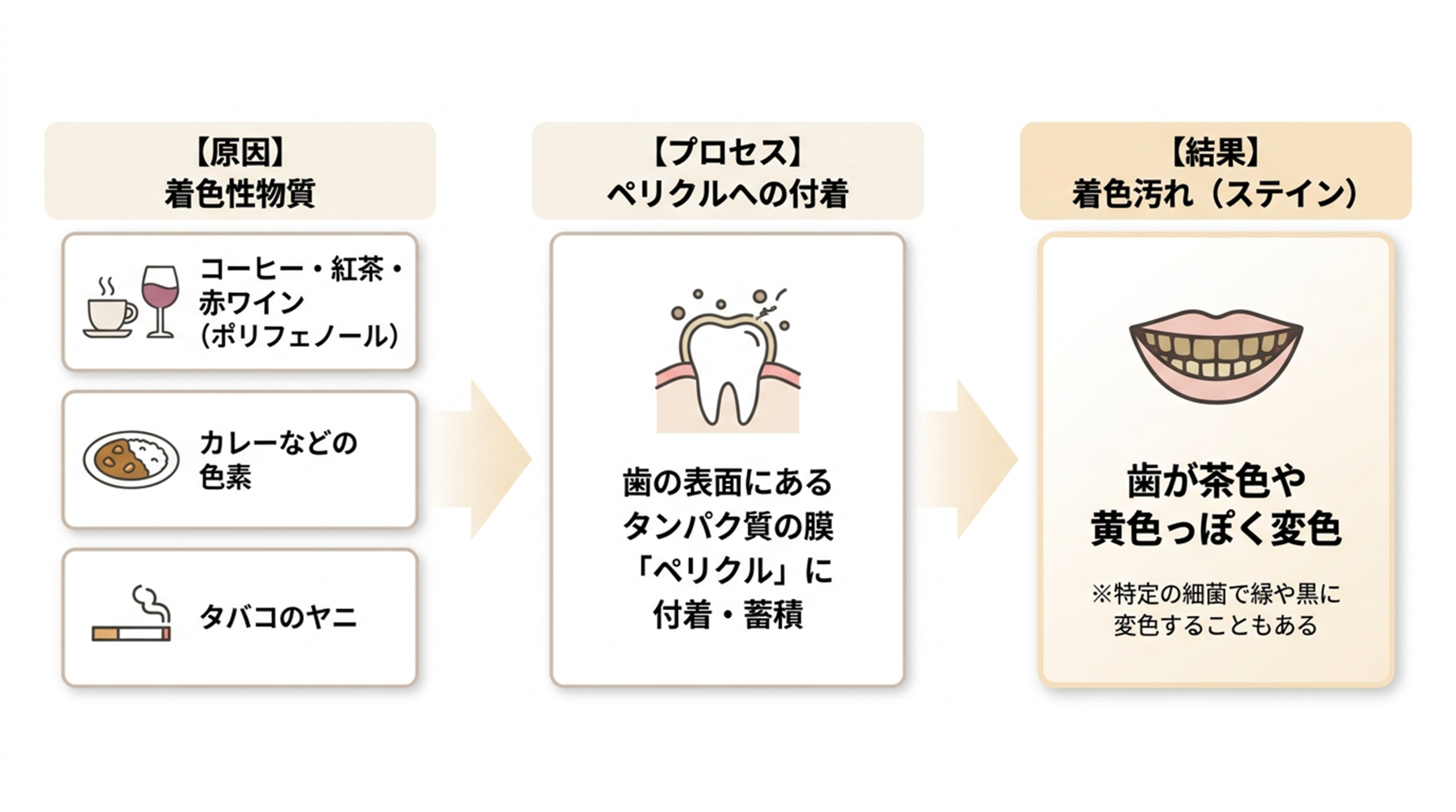 外因性ステインのメカニズム（原因・プロセス・結果）
